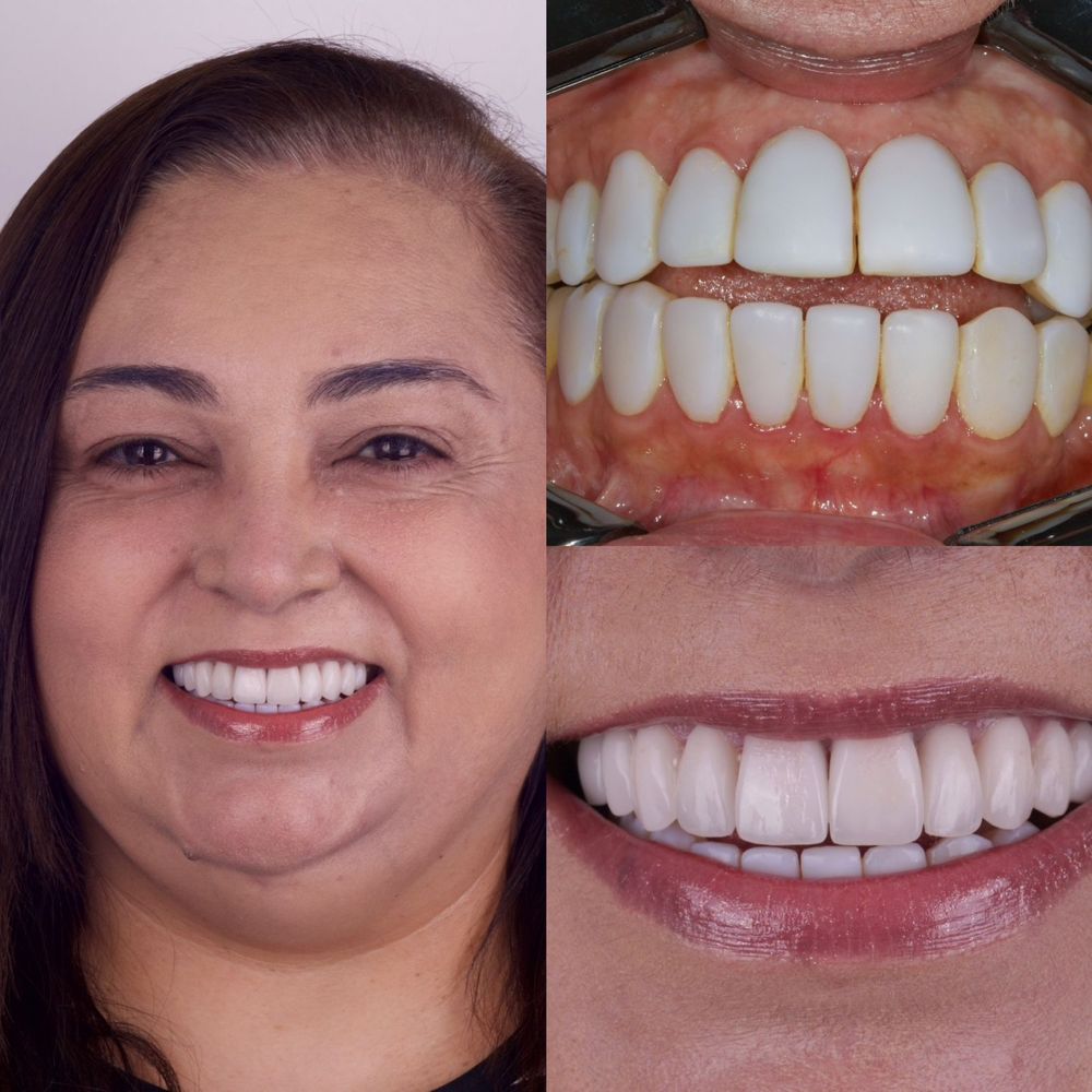 Resultado de sorriso