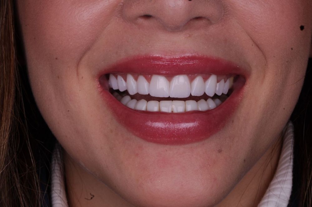 Resultado de sorriso